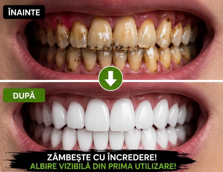 5D WHITE™ – Pudră pentru Albirea Dinților cu Cărbune Activ din Bambus
